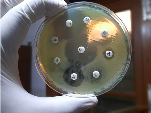 New Superbug-Killing Antibiotic Discovered Using AI post image